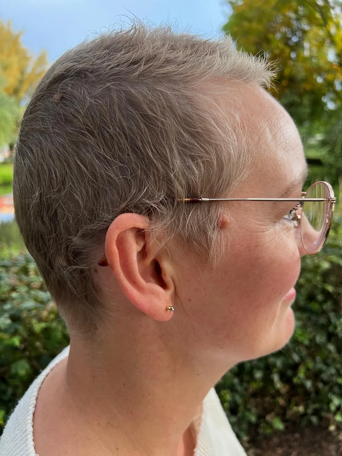 Achterkant van het hoofd met de eerste fijne haartjes, ongeveer drie maanden na haaruitval door chemotherapie